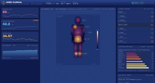 NABS clinical telemetry console showing vitals, thermal ROI, NPUAP staging and propagation model