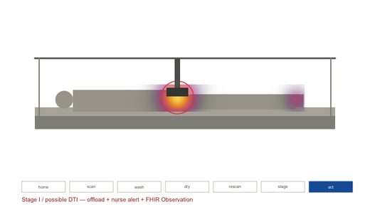 Frame from the NABS process cycle animation showing the gantry over a supine patient